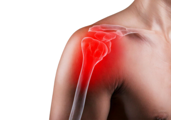 Inflamed shoulder (Turns slightly red). isolated on transparent or white background