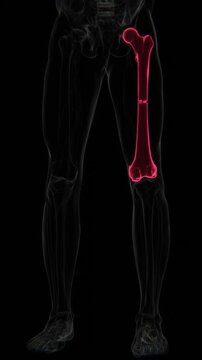Transverse Fracture in Vertical HQ Video | X-ray video showing a transverse fracture