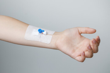 Long Peripheral Catheter for Multiday Therapy on human hand