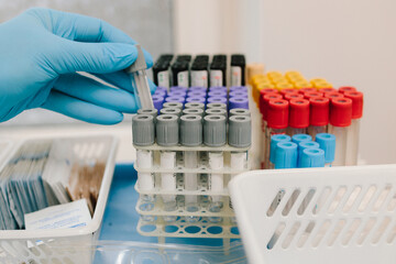 Gynecologist holds blood collection tubes for laboratory tests in the gynecology clinic. Blood...
