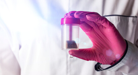 Doctor laboratory assistant in a pink glove holds a stool test. Concept for examining stool for...