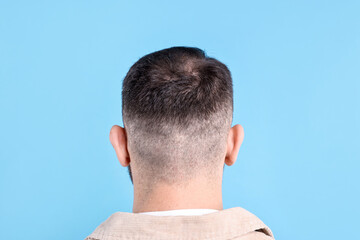 Obraz premium Baldness problem. Man with bald spot on light blue background, back view
