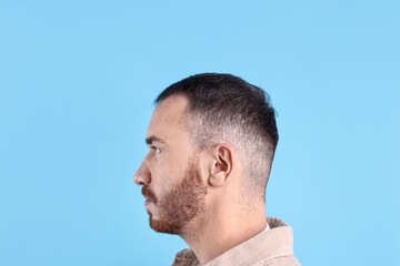 Obraz premium Baldness problem. Man with receding hairline on light blue background