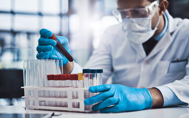 Blood sample, test tube and hands of scientist in lab for dna testing, monitor disease progress or...
