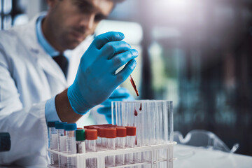 Blood sample, test tube and hands of scientist with dropper for medical research, dna testing or...