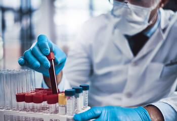 Hands, man and scientist with blood test at lab of medical virus, study dna and drug development....