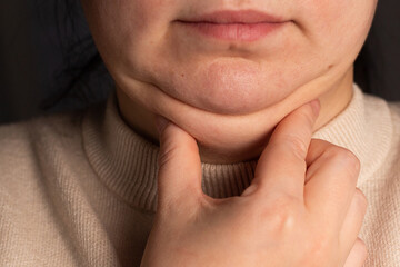 Closeup of woman second chin. Overweight problem. Facial line correction concept.