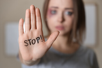 Bruised young woman showing stop gesture at home, closeup. Domestic violence concept