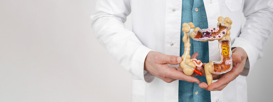 Anatomical intestines model with pathology in male hands, close-up. Treatment of colitis, flatulence, indigestion in healthcare