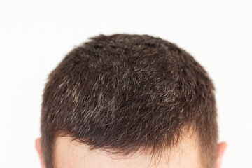 Fototapeta premium A close up photo of the head of an adult brunette man with beginning greying hair. The first signs of a man's gray hair