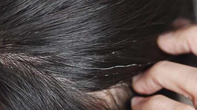 woman scratching her head with her fingers