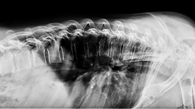 MRI scan timelapse of various sides human body, spine, coccyx bones, pelvis, lumbar. Magnetic resonance imaging of skeleton parts, CT, x-ray, side view, stop motion animation. Seamless loop.