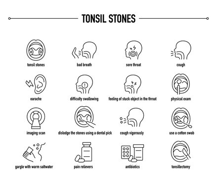 Tonsil Stones symptoms, diagnostic and treatment vector icon set. Line editable medical icons