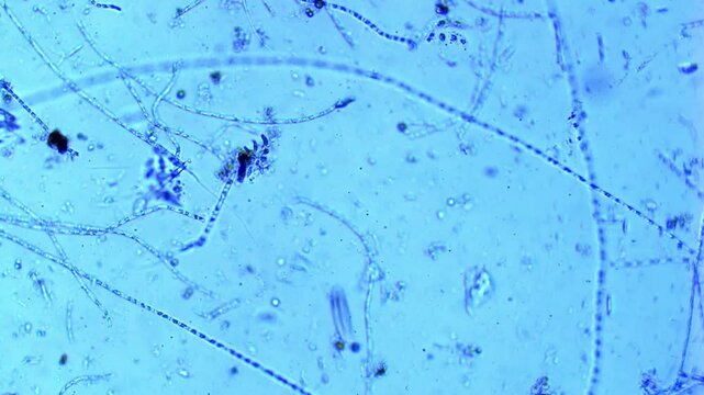 Ciliates, algae, and rotifers in freshwater - 100x magnification