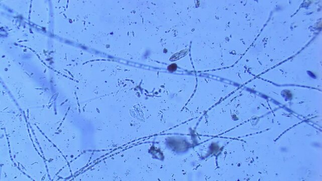 Freshwater protozoa rotifer algae diatom under microscope-100x magnification