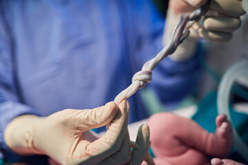 Hands, doctor and umbilical cord with baby in hospital for delivery, check or assessment for...