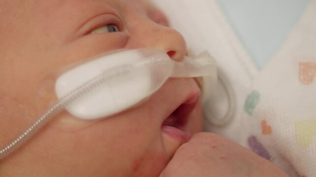 Closeup of a Newborn Baby with Oxygen Tubes