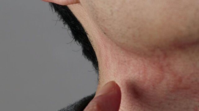 髭剃り後の肌荒れを指差す日本人男性