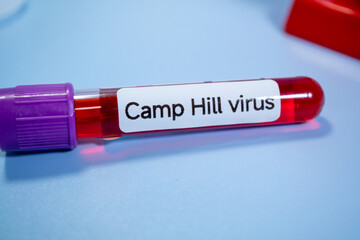 Obraz premium A new pathogen, called Camp Hill virus, was recently discovered in Alabama, drawing attention to a group of viruses known as henipaviruses
