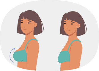 Woman had plastic surgery for breasts, inserting implants to increase size or improve firmness. Comparison of two girls before and after breast surgery and lifting of sagging nipples