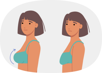 Woman had plastic surgery for breasts, inserting implants to increase size or improve firmness. Comparison of two girls before and after breast surgery and lifting of sagging nipples