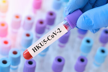 Potential pandemic: HKU5-CoV-2 virus test, doctor holding blood sample. Bat coronavirus discovery in China, like COVID-19 spread.