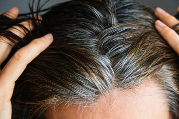 Naklejka premium Going gray. Middle aged woman with dark brown hair and regrown gray hair roots. Aging, hormonal changes, health problems