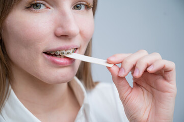 Young woman with metal braces on her teeth is chewing gum. The girl is eating gummy candy