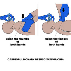Cardiopulmonary resuscitation (CPR), emergency procedure.