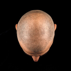 Close-up top view of a bald man's head with short stubble, isolated on a black background.