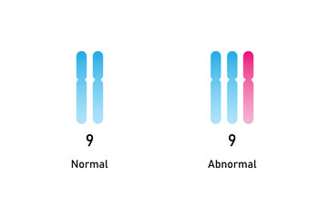 Trisomy 9 Syndrome Science Design. Vector Illustration.