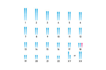 Trisomy 18 Syndrome Science Design. Vector Illustration.