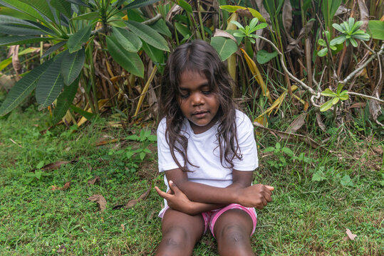 Sore 4 yo aboriginal child