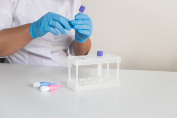 Medical laboratory doctor preparing workplace for making children blood tests