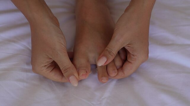 Close-up of a young woman showing a damaged toenail after an injury. The nail is partially missing due to trauma, revealing the sensitive nail bed. The effects of nail damage and regrowth