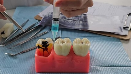 Pain-relieving tooth injections. Injection of anesthetic into gum and anesthesia for tooth treatment. Dental care and pain medications