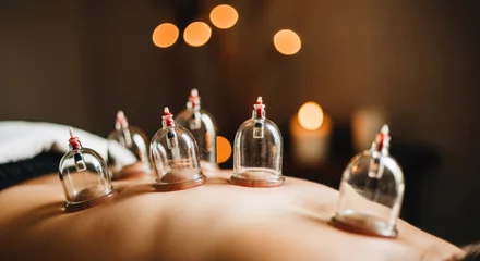Cupping therapy session in a tranquil spa environment with soft lighting and candles for relaxation