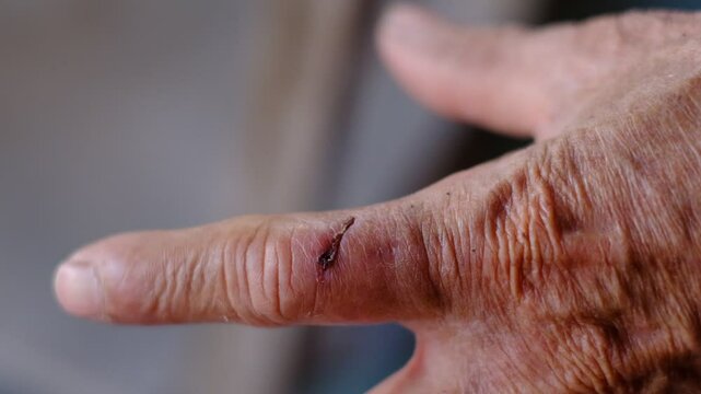 A hand with a cut on it. The cut is on the finger and is red. The hand is wrinkled and has a bandage on it
