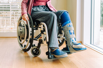 Detail or woman in a wheelchair with leg brace after sport injury