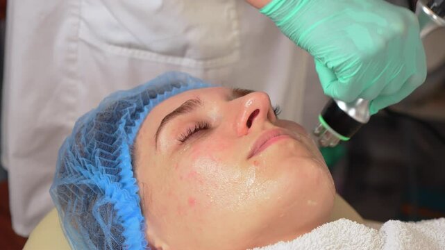 Close up of hardware cosmetology of face. Woman doing lifting facial skin therapy. Anti aging procedure. Beautician in gloves conducts ultrasonic cavitation face contouring procedure of young woman in