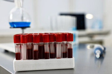 Tubes with blood samples on table in laboratory, closeup. Space for text