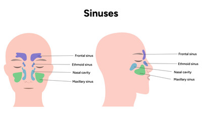 Sinuses anatomy. Nose nasal anatomy. Inflammation Nasal Cavity