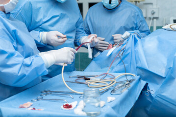 Otolaryngologist performs tonsillectomy, removal of tonsils, ENT. septoplasty, maxillofacial...