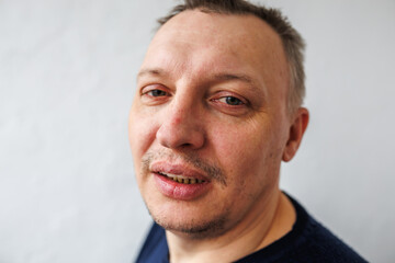 Fototapeta premium face of angry person dissatisfied with life and everything that happens. man is grimacing