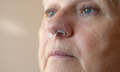 Portrait of aged woman wearing nose anti-snoring device.