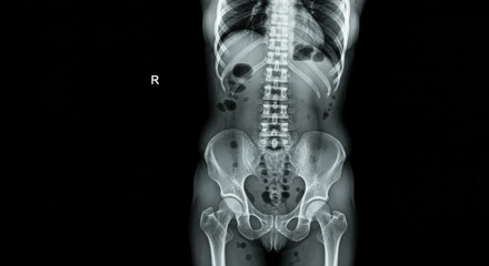 X ray image displaying human skeleton anatomy scan