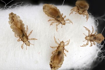 Head louse, Pediculus humanus capitis, lice on an ear cleaning stick.