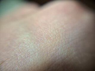 Fototapeta premium Close-up of human skin texture highlighting details and patterns. Ideal for health, beauty, and skincare concepts.
