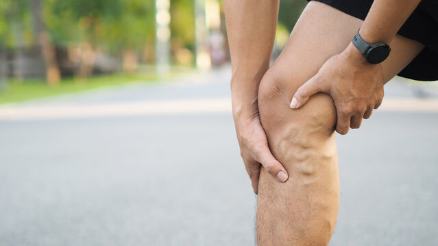 Varicose veins on the legs of men