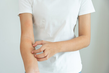 skin problem and beauty. Young woman scratch body has itchy skin from skin allergic, steroid...